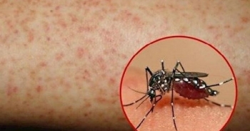 Phòng ngừa bệnh sốt xuất huyết trong mùa dịch cao điểm