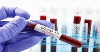 Bộ Y tế ra công văn khẩn yêu cầu các Sở Y tế sẵn sàng xét nghiệm tại chỗ vi rút SARS-CoV-2