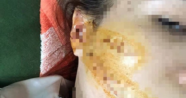 Thanh Hoá: Điều tra vụ nữ công nhân bị chồng cầm dao truy sát khi đang tăng ca