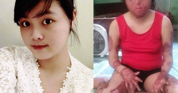 Hà Nội: Đã bắt được người chồng dùng xăng thiêu sống vợ