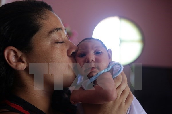 Một em b&eacute; bị mắc chứng bệnh đầu nhỏ do mẹ bị nhiễm virus Zika khi mang thai tại Marica, Rio de Janeiro, Brazil. (Nguồn: THX/TTXVN)