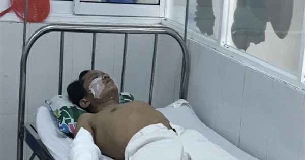 Quảng Nam: 4 công nhân nhập viện sau vụ nổ thiết bị nhà máy gạch