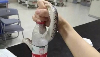 Bị cắn, cô gái túm cổ con rắn mang tới bệnh viện