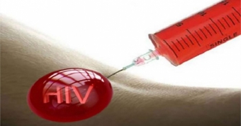 Cách xử lý khi tiếp xúc kim nhiễm HIV