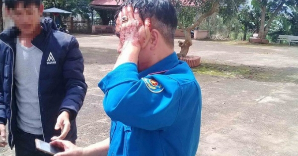 Lâm Đồng: Hai người trong đoàn giải tỏa bị đánh nhập viện