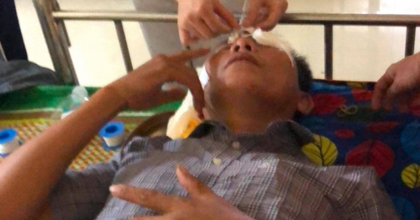 Nghệ An: Làm đơn tố cáo, một ứng viên trưởng thôn bị hất chất lạ vào mặt