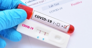 Bộ Y tế cấp phép 16 loại test nhanh kháng nguyên SARS-CoV-2
