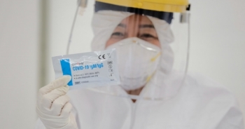 Bộ Y tế công bố 7 loại test nhanh SARS-CoV-2