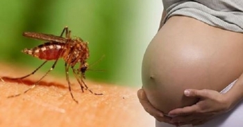 Singapore xác nhận một phụ nữ mang thai đầu tiên nhiễm vi rút zika
