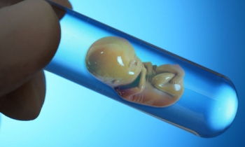 Em bé đầu tiên được lọc gene bệnh tan máu khi thụ tinh trong ống nghiệm