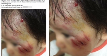 Hà Nội: Truy tìm nam thanh niên phóng mô tô tông bé gái 11 tháng trầy xước mặt rồi bỏ chạy