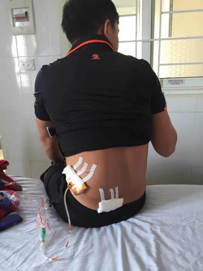 Nạn nh&acirc;n Nguyễn Xu&acirc;n T hiện đang điều trị tại BV Đa khoa tỉnh H&agrave; Tĩnh.