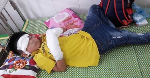 Nghệ An: Điện thoại phát nổ, bé trai 7 tuổi dập nát 2 bàn tay