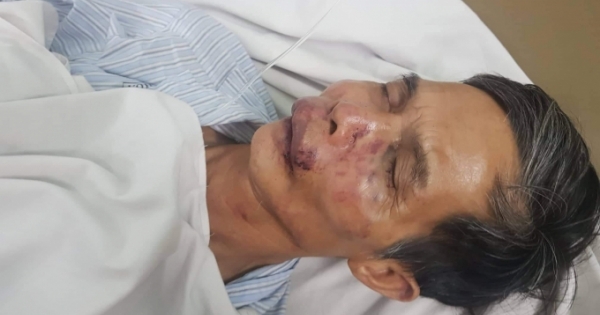 Phóng viên Tạp chí Luật sư Việt Nam bị đánh chấn thương sọ não do phát hiện xe chở gỗ không rõ nguồn gốc?