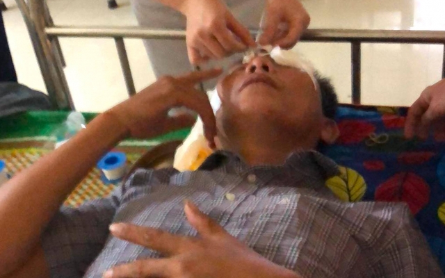 Nghệ An: Làm đơn tố cáo, một ứng viên trưởng thôn bị hất chất lạ vào mặt