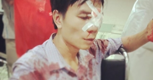 Nghệ An: Cán bộ địa chính xã Quỳnh Bá bị tố dùng xẻng đánh gục người đàn ông sau va chạm giao thông