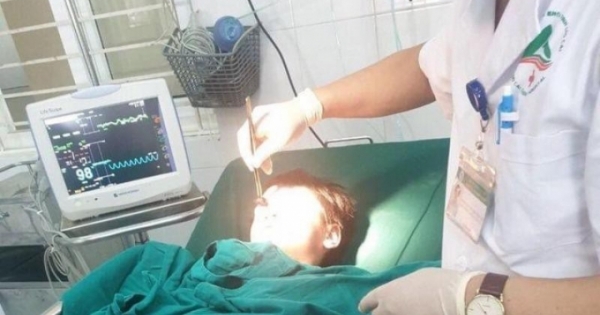 Lào Cai: Quạt trần rơi trúng đầu, một học sinh tiểu học phải nhập viện