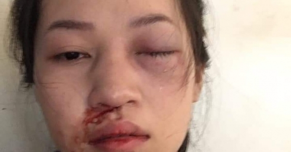 Tuyên Quang: Điều tra nghi án CSGT dùng gậy vụt vào mặt người phụ nữ vi phạm giao thông?