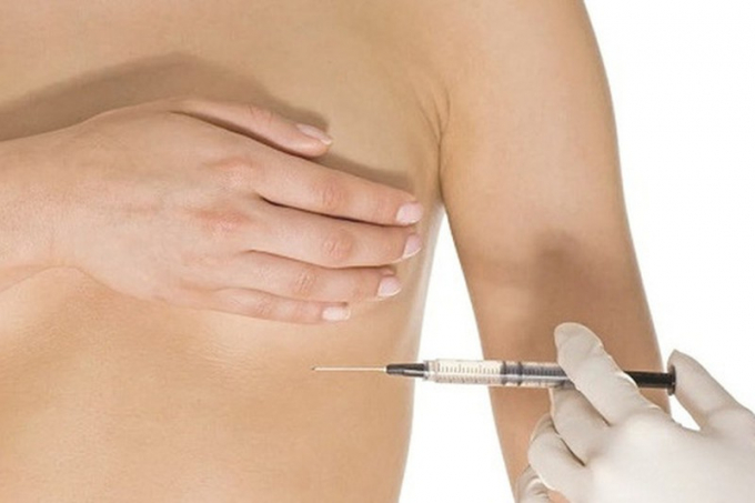 Hàng ngàn phụ nữ trên thế giới nâng ngực bằng sillicon.