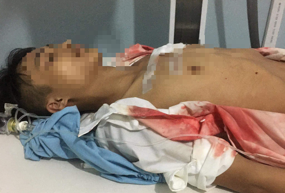 Hà Giang: Điều tra vụ nam học sinh lớp 11 bị đâm thấu ngực trước cổng trường