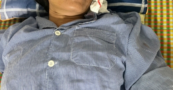 Bắc Giang: Một phụ nữ bị hành hung dã man tại nhà riêng ở huyện Việt Yên