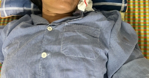 Bắc Giang: Một phụ nữ bị hành hung dã man tại nhà riêng ở huyện Việt Yên