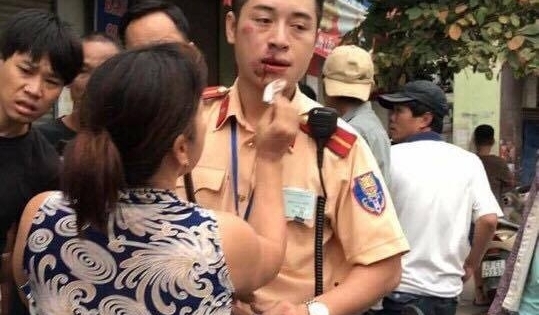 Hà Nội: Khởi tố thanh niên 9X đấm CSGT gãy hai răng cửa