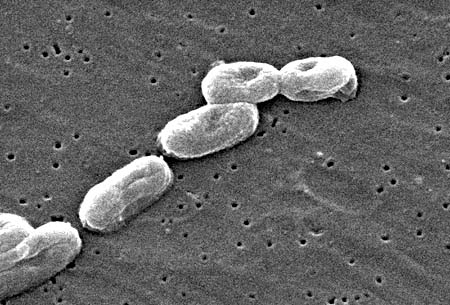 Vi khuẩn Burkholderia pseudomallei (nguồn:http://diendanykhoa.com)