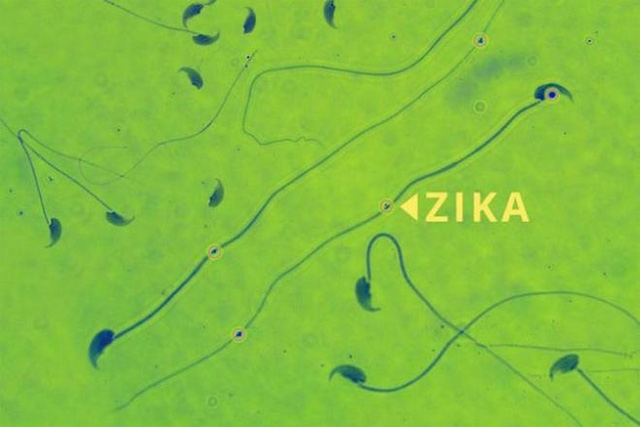 Theo nghi&ecirc;n cứu,&nbsp;tinh ho&agrave;n của chuột bị nhiễm Zika teo nhỏ khoảng 90% về trọng lượng. Ảnh: Internet.