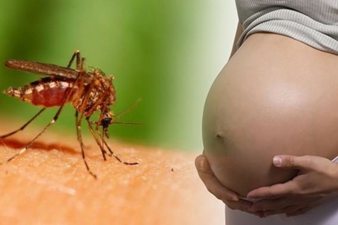 Virus Zika l&agrave; một trong những nguy&ecirc;n nh&acirc;n g&acirc;y dị tật đầu nhỏ ở trẻ em. Ảnh: minh họa