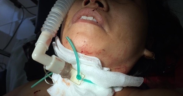 Thái Nguyên: Nữ chủ tiệm cắt tóc bị cứa cổ đã qua cơn nguy kịch