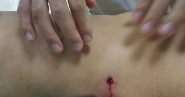 Vụ nhóm thanh niên nổ súng ở Xuân La: Một phụ nữ bị trúng đạn