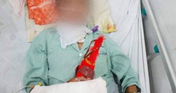 Bé gái 14 tuổi bị cắt cổ, cưỡng hiếp phải chuyển lên Hà Nội cấp cứu