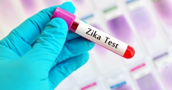 Đã tìm thấy kháng thể chống virus Zika