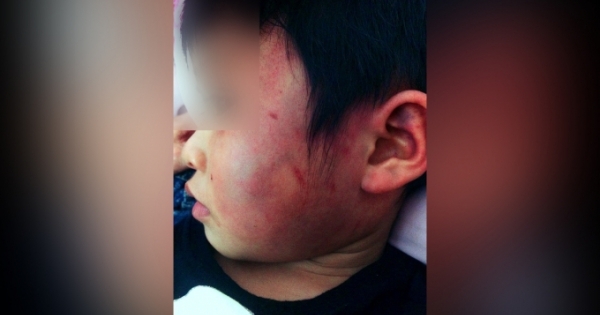 Bắc Giang: Sáng mai tổ chức họp báo vụ cháu bé 4 tuổi nghi bị bạo hành