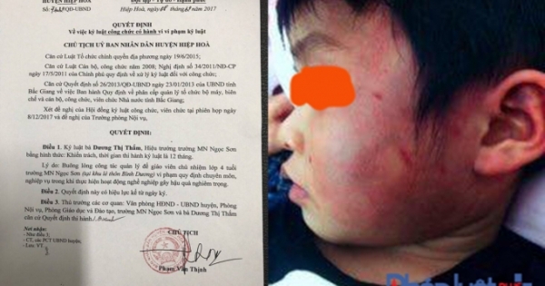 Vụ cháu bé ở Bắc Giang bị đánh bầm tím: Kỷ luật Hiệu trưởng và giáo viên