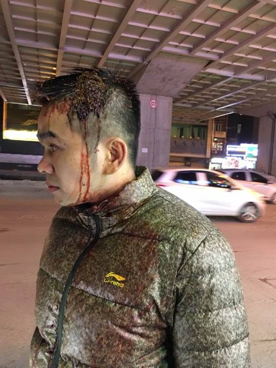 Anh Nguyễn Kim Đ&iacute;nh bị thương ở v&ugrave;ng đầu.