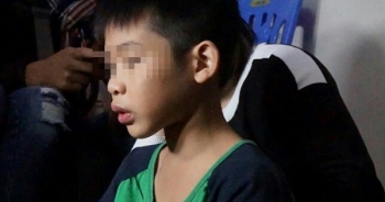Chủ tịch Hà Nội chỉ đạo xử lý vụ người bố đánh con đến gãy răng, người chi chít vết thương
