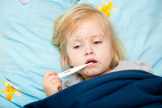 Bệnh sởi khiến trẻ mệt mỏi, sốt cao v&agrave; dễ dẫn đến biến chứng nguy hiểm.