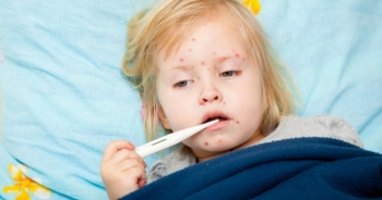 Bài xích vắc xin – liệu chúng ta có nên để con mình nguy hiểm