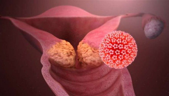 Khối u chứa tế b&agrave;o ung thư khiến c&aacute;c hạt nano chuyển m&agrave;u hồng