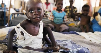 UNICEF: Trên 10 triệu trẻ em châu Phi đứng trước nguy cơ bị suy dinh dưỡng cấp tính năm 2021