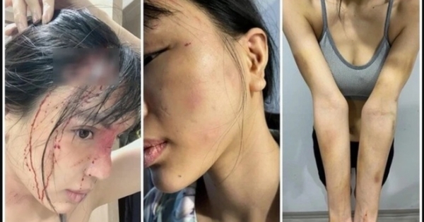 Điều tra nghi án siêu mẫu Khả Trang bị bạn trai bạo hành?