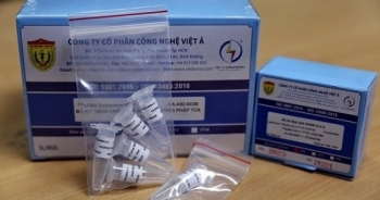 Quảng Nam chỉ mượn 3 hệ thống xét nghiệm Realtime PCR tự động, không mua kít test xét nghiệm